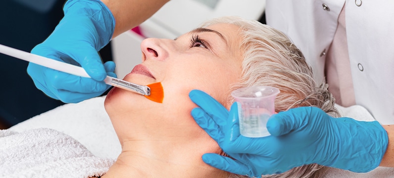 female patient having a chemical peel procedure on her face