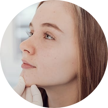 doctor holding the chin of a young female to discuss acne treatment options