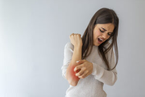 Young woman scratching arm from having itching on white background. Cause of itchy skin include insect bites, dermatitis, food/drugs allergies or dry skin. Health care concept. Close up.