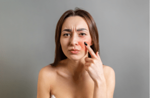 woman points a finger at a red cheek with inflammation