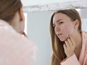 woman with acne problem near mirror in bathroom